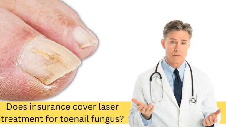 Does insurance cover laser treatment for toenail fungus?