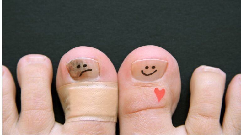Finding the Right Clinic for Treating Toenail Fungus Near Your Location