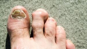 Navigating Toenail Troubles: When to Visit a Professional Spa