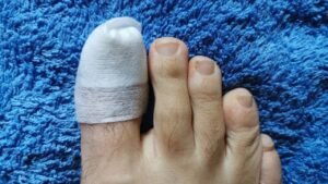 The ABCs of Toenail Care: Essential Tips for Long-Term Toenail Health