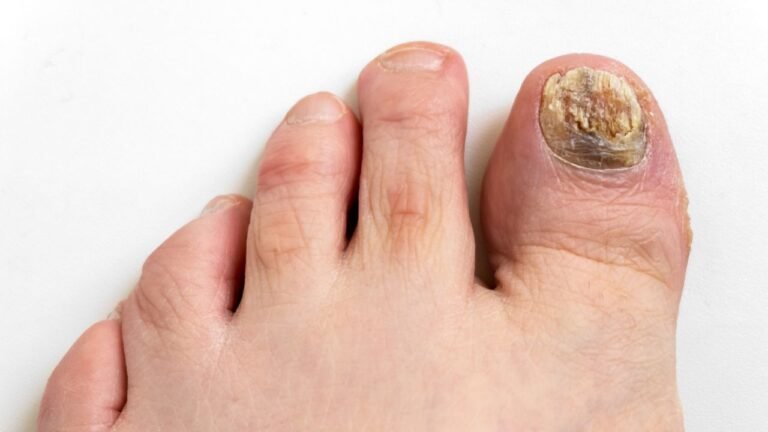 What Causes Ugly Toenails?
