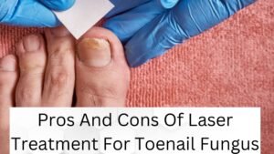 Pros And Cons Of Laser Treatment For Toenail Fungus