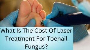 What Is The Cost Of Laser Treatment For Toenail Fungus?