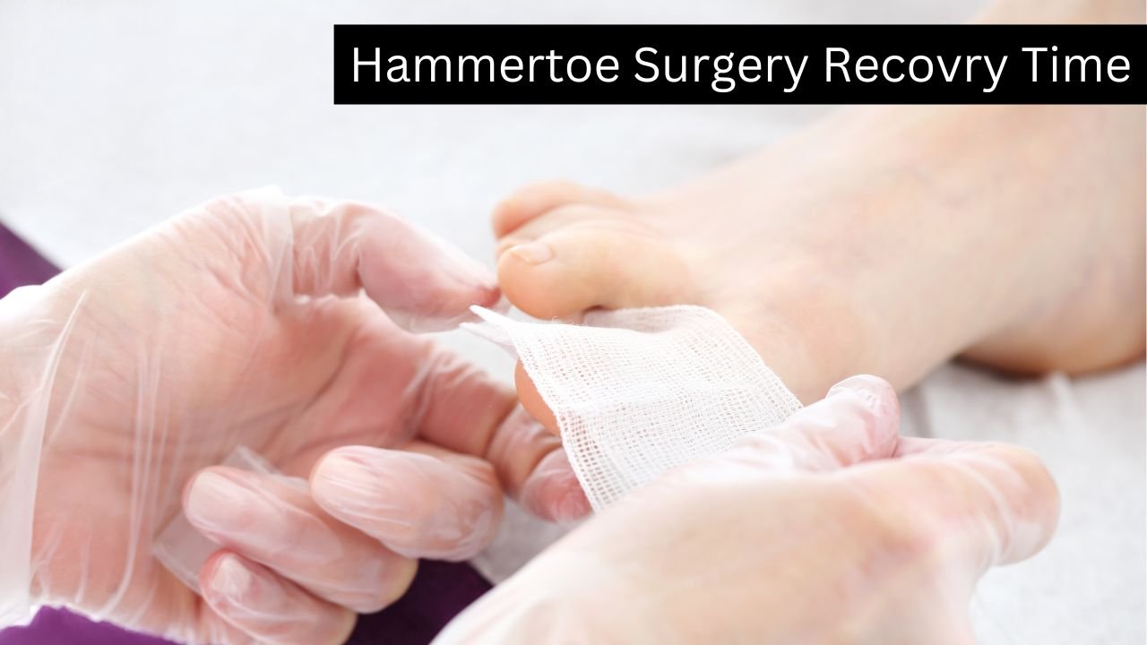 How Long does it take to Recover From Hammer Toe Surgery? 1 How Long does it take to Recover From Hammer Toe Surgery
