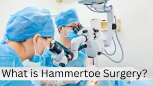 What is Hammertoe Surgery?