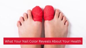 Is Your Nail Color Trying to Tell You Something?