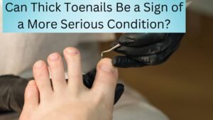 Can Thick Toenails Be a Sign of a More Serious Condition?