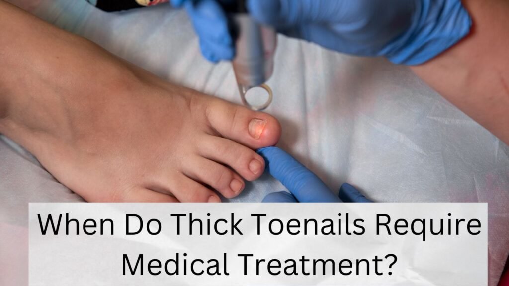When Do Thick Toenails Require Medical Treatment? 1 When Do Thick Toenails Require Medical Treatment?