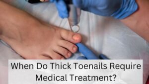When Do Thick Toenails Require Medical Treatment?