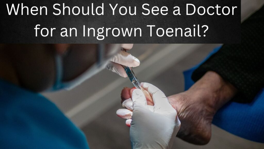 When Should You See a Doctor for an Ingrown Toenail?