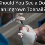 When Should You See a Doctor for an Ingrown Toenail?