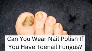Can You Wear Nail Polish If You Have Toenail Fungus?