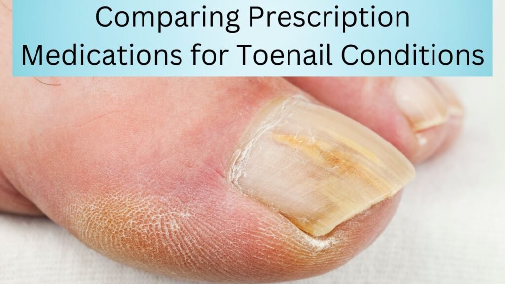 Comparing Prescription Medications for Toenail Conditions 1 Comparing Prescription Medications for Toenail Conditions