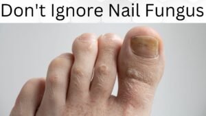 Don’t Ignore Nail Fungus: 10 Solutions That Change Everything