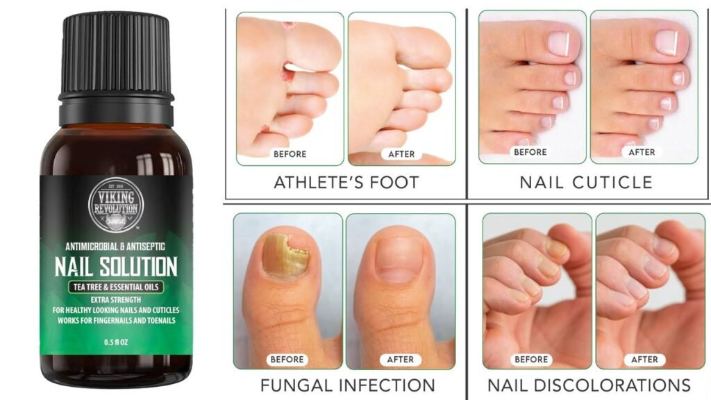 Best Toenail Fungus Treatments Products at Walmart 3 Untitled design 2