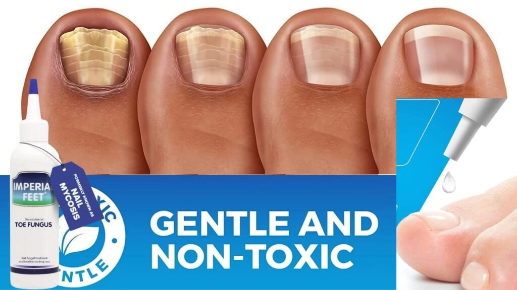 Best Toenail Fungus Treatments Products at Walmart 4 Untitled design 3