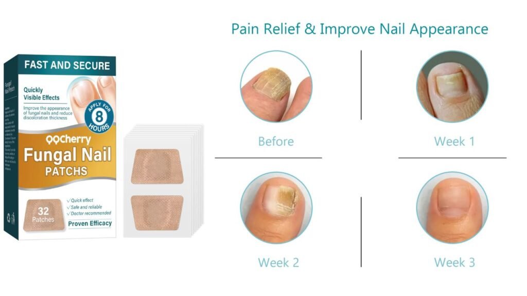 Best Toenail Fungus Treatments Products at Walmart 5 Untitled design 4
