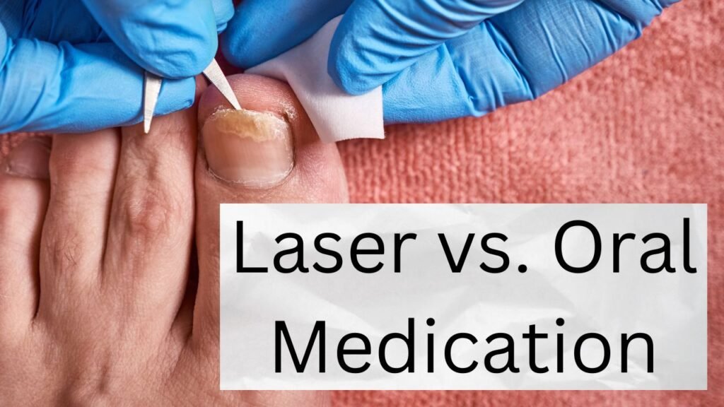 Laser vs. Oral Medication: Which Is Best for Toenail Fungus? 1 Which Is Best for Toenail Fungus
