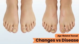 Age-Related Toenail Changes vs Disease