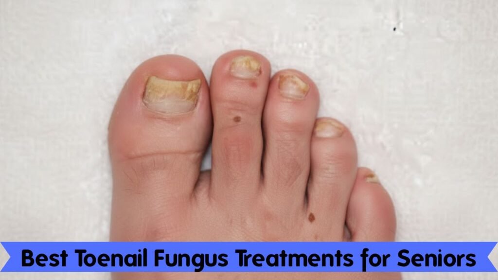 Best Toenail Fungus Treatments for Seniors: Safe, Effective Options That Actually Work 1 Best Toenail Fungus Treatments for Seniors