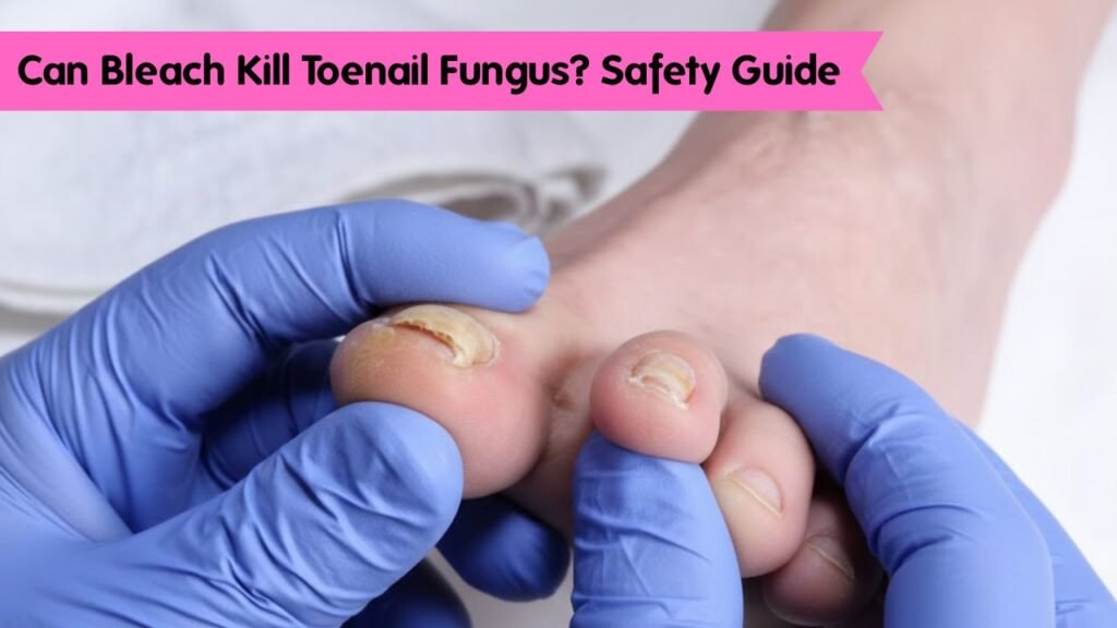 Can Bleach Kill Toenail Fungus? Safety Guide