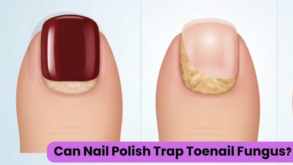 Can Nail Polish Trap Toenail Fungus? The Honest Truth Most People Miss 1 Can Nail Polish Trap Toenail Fungus?