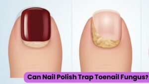 Can Nail Polish Trap Toenail Fungus? The Honest Truth Most People Miss
