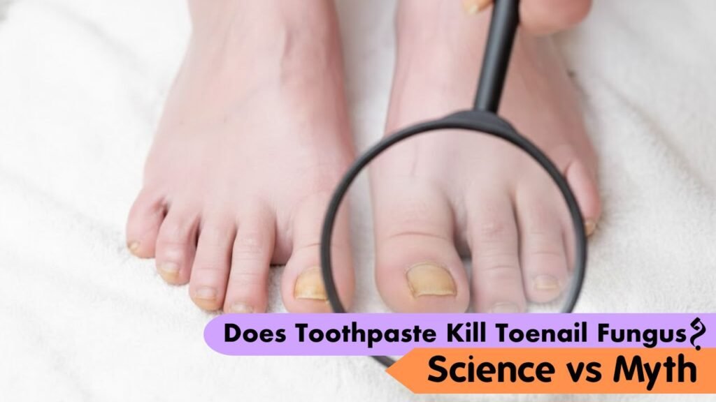 Does Toothpaste Kill Toenail Fungus? Science vs Myth 1 Does Toothpaste Kill Toenail Fungus? Science vs Myth