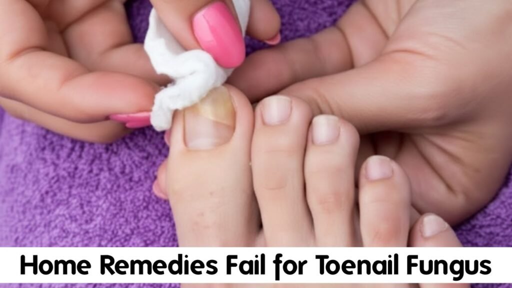 Why Most Home Remedies for Toenail Fungus Fail 1 Why Most Home Remedies Fail for Toenail Fungus