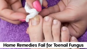 Why Most Home Remedies for Toenail Fungus Fail