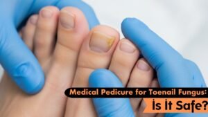 Medical Pedicure for Toenail Fungus: Is It Safe?