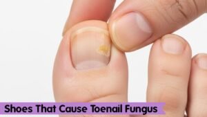 Shoes That Cause Toenail Fungus (Material & Fit Explained)