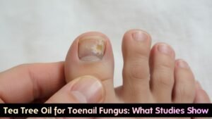 Tea Tree Oil for Toenail Fungus: What Studies Really Show