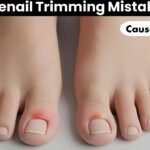 Toenail Trimming Mistakes That Cause Problems