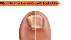 What Healthy Toenail Growth Looks Like: A Simple At-Home Check You Can Trust