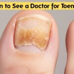 When to See a Doctor for Toenail Fungus