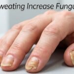 Does Sweating Increase Fungus Risk?