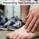 Preventing Nail Damage During Sports