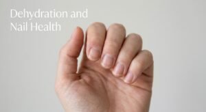 Dehydration and Nail Health – Why Dry Nails Develop Vertical Ridges